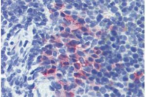 Mouse spleen: Formalin-Fixed, Paraffin-Embedded (FFPE) (CD11b Antikörper)