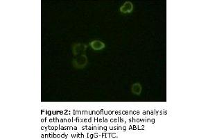 Image no. 2 for anti-ABL2 (ABL2) antibody (ABIN230671)