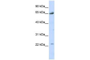 WB Suggested Anti-P2RX2 Antibody Titration:  0. (P2RX2 Antikörper  (Middle Region))