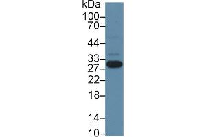 Detection of NNMT in Human Hela cell lysate using Polyclonal Antibody to Nicotinamide-N-Methyltransferase (NNMT)