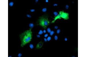 Immunofluorescence (IF) image for anti-Proteasome (Prosome, Macropain) 26S Subunit, Non-ATPase, 2 (PSMD2) antibody (ABIN1500481) (PSMD2 Antikörper)