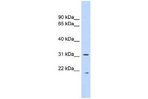 Calpain 4 antibody used at 1 ug/ml to detect target protein. (Calpain S1 Antikörper  (Middle Region))