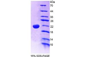SDS-PAGE analysis of Human PTPN13 Protein. (PTPN13 Protein)
