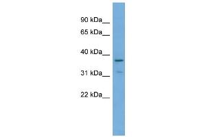 WB Suggested Anti-TOB1 Antibody Titration: 0. (Protein Tob1 (TOB1) (Middle Region) Antikörper)