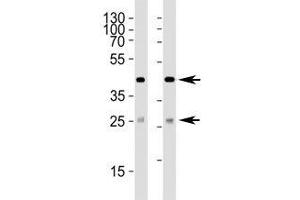 Western blot analysis of lysate from (1) 293 and (2) HepG2 cell line using SIRT3 antibody at 1:1000. (SIRT3 Antikörper  (AA 250-279))