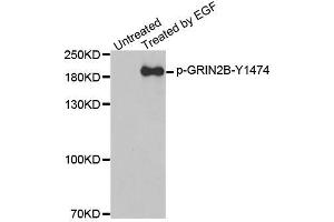 Western blot analysis of extracts from A431 cells, using Phospho-GRIN2B-Y1474 antibody (ABIN2988034). (GRIN2B Antikörper  (pTyr1474))