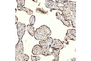 IHC analysis of U1A/SNRPA using anti-U1A/SNRPA antibody (ABIN7600891). (SNRPA1 Antikörper  (AA 25-218))
