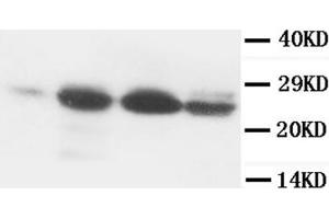 Western Blotting (WB) image for anti-B-Cell CLL/lymphoma 2 (BCL2) (AA 41-54) antibody (ABIN1105504) (Bcl-2 Antikörper  (AA 41-54))