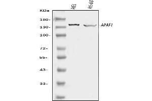 Western blot analysis of APAF1 using anti-APAF1 antibody (ABIN7598969).