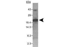 Western blot analysis of XAGE1 on purified His-XAGE1 (100 ug) with XAGE1 polyclonal antibody .