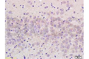 Formalin-fixed and paraffin embedded rat brain labeled with Anti- NCX2/SLC8A2 Polyclonal Antibody, Unconjugated (ABIN676478) at 1:200 followed by conjugation to the secondary antibody and DAB staining (SLC8A2 Antikörper  (AA 601-700))
