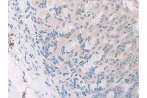 Immunohistochemistry (IHC) image for anti-Growth Differentiation Factor 5 (GDF5) (AA 358-495) antibody (ABIN7437095)