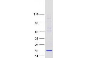 Validation with Western Blot (LALBA Protein (Myc-DYKDDDDK Tag))