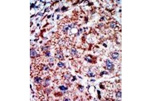 Image no. 2 for anti-Phosphofructokinase, Liver (PFKL) (C-Term) antibody (ABIN360629) (PFKL Antikörper  (C-Term))