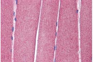 Immunohistochemistry (Formalin-fixed Paraffin-embedded Sections) (IHC (fp)) image for anti-Potassium Voltage-Gated Channel, Shaw-Related Subfamily, Member 4 (KCNC4) (AA 252-301) antibody (ABIN6747010)