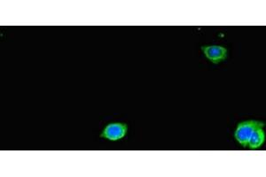 Immunofluorescent analysis of HepG2 cells using ABIN7171544 at dilution of 1:100 and Alexa Fluor 488-congugated AffiniPure Goat Anti-Rabbit IgG(H+L) (TAS2R38 Antikörper  (AA 212-251))
