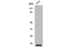 Western Blot analysis of A549 cells using Cystatin 11 Polyclonal Antibody (CST11 Antikörper  (C-Term))