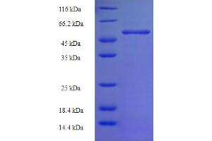 SDS-PAGE (SDS) image for Ornithine Carbamoyltransferase (OTC) (AA 33-354) protein (His-SUMO Tag) (ABIN5710053) (OTC Protein (AA 33-354) (His-SUMO Tag))