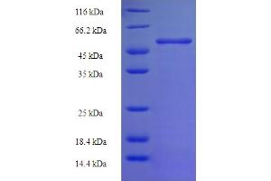 SDS-PAGE (SDS) image for Ornithine Carbamoyltransferase (OTC) (AA 33-354) protein (His-SUMO Tag) (ABIN5710053)