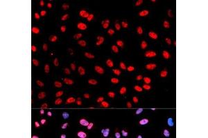 Immunofluorescence analysis of U2OS cells using Phospho-ESPL1(S1126) Polyclonal Antibody (Separase Antikörper  (pSer1126))