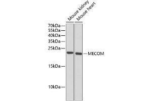 Western blot analysis of extracts of various cell lines, using MECOM antibody (ABIN6132516, ABIN6143677, ABIN6143679 and ABIN6221326) at 1:1000 dilution. (MECOM Antikörper  (AA 1-120))
