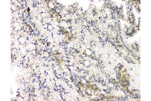 IHC analysis of RHOB using anti-RHOB antibody (ABIN6719538).