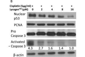 Western Blotting (WB) image for anti-Proliferating Cell Nuclear Antigen (PCNA) antibody (ABIN2854788)