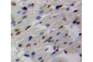 Used in DAB staining on fromalin fixed paraffin-embedded Heart tissue (SMAD6 Antikörper  (AA 116-364))