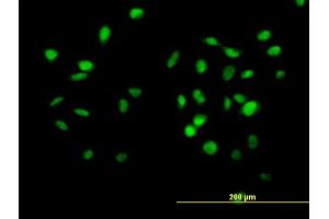 Immunofluorescence of purified MaxPab antibody to CUL4B on HeLa cell. (Cullin 4B Antikörper  (AA 1-913))