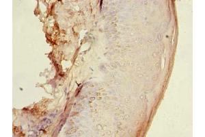 Immunohistochemistry of paraffin-embedded human skin tissue using ABIN7154963 at dilution of 1:100 (HEMK1 Antikörper  (AA 1-338))