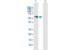 Western Blot analysis of NOXA1 expression in transfected 293T cell line by NOXA1 MaxPab polyclonal antibody.