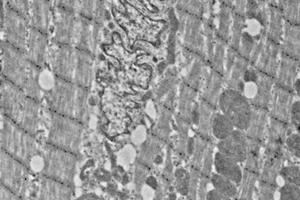 Immunoelectron microscopy analysis of LR white resin-embedded mouse heart using alpha Actinin 2 (ABIN7075510) at dilution of 1: 50. (Sarcomeric alpha Actinin Antikörper)