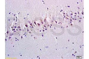 Formalin-fixed and paraffin embedded rat brain tissue labeled with Anti-Emp1/MUC1 Polyclonal Antibody, Unconjugated at 1:200, followed by conjugation to the secondary antibody and DAB staining