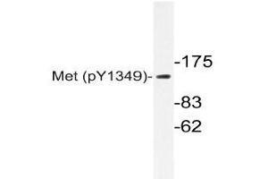 Western blot (WB) analyzes of p-Met antibody in extracts from HepG2 cells. (c-MET Antikörper  (pTyr1349))