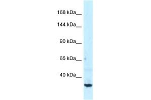 Western Blotting (WB) image for anti-Spectrin Beta, Non-Erythrocytic 1 (SPTBN1) (C-Term) antibody (ABIN2788921)