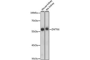 Western blot analysis of extracts of various cell lines, using ZNF766 antibody (ABIN7271530) at 1000 dilution. (ZNF766 Antikörper  (AA 60-190))