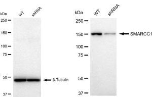 Western blotting analysis using SMARCC1 antibody (ABIN7800479).
