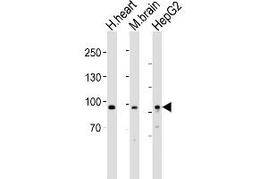 All lanes : Anti-PROX1 Antibody (Center) at 1:1000 dilution Lane 1: human heart lysates Lane 2: mouse brain lysates Lane 3: HepG2 whole cell lysates Lysates/proteins at 20 μg per lane. (PROX1 Antikörper  (AA 444-478))
