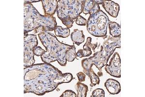 anti-Hydroxysteroid (11-Beta) Dehydrogenase 2 (HSD11B2) (AA 96-377) antibody