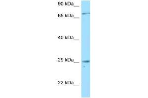 Western Blotting (WB) image for anti-Tumor Necrosis Factor Receptor Superfamily, Member 13B (TNFRSF13B) (N-Term) antibody (ABIN2789582) (TACI Antikörper  (N-Term))