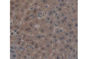 Immunohistochemistry (IHC) image for anti-Nuclear Receptor Subfamily 1, Group I, Member 3 (NR1I3) (AA 1-247) antibody (ABIN5013390)