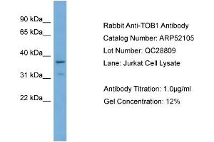WB Suggested Anti-TOB1  Antibody Titration: 0. (Protein Tob1 (TOB1) (Middle Region) Antikörper)