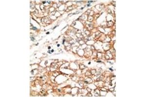 Image no. 2 for anti-BCL2-Related Ovarian Killer (BOK) (BH3 Domain), (N-Term) antibody (ABIN356820) (BOK Antikörper  (BH3 Domain, N-Term))