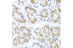 Immunohistochemistry of paraffin-embedded human stomach using ACP1 antibody at dilution of 1:100 (x40 lens). (ACP1 Antikörper)