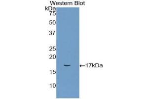 Detection of Recombinant CD72, Rat using Polyclonal Antibody to Cluster Of Differentiation 72 (CD72) (CD72 Antikörper  (AA 126-237))