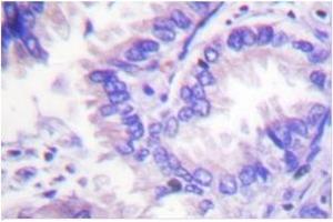 Image no. 1 for anti-Protein Phosphatase 2, Catalytic Subunit, alpha Isozyme (PPP2CA) antibody (ABIN272071)