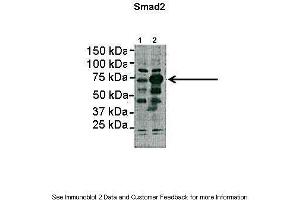 Lanes:   Lane1: 2ug HEK293lysate Lane2: 2ug SMAD2 transfected HEK293 lysate  Primary Antibody Dilution:   1:1000  Secondary Antibody:   Anti-rabbit HRP  Secondary Antibody Dilution:   1:5000  Gene Name:   SMAD2  Submitted by:   Dominique Alfandari, University of Massachusetts (SMAD2 Antikörper  (N-Term))