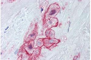 Human Placenta (formalin-fixed, paraffin-embedded) stained with MCAM antibody ABIN462314 followed by biotinylated goat anti-rabbit IgG secondary antibody ABIN481713, alkaline phosphatase-streptavidin and chromogen. (MCAM Antikörper  (Tyr641))