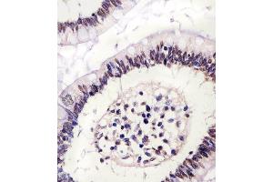 (ABIN6243085 and ABIN6578223) staining CTCF in human colon tissue sections by Immunohistochemistry (IHC-P - paraformaldehyde-fixed, paraffin-embedded sections). (CTCF Antikörper  (AA 334-364))