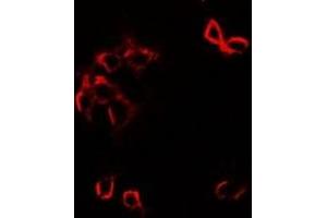 Immunofluorescent analysis of GFRA1 staining in SW480 cells.